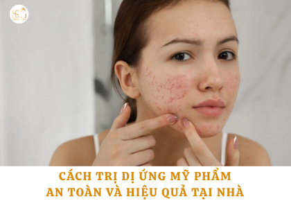 Cách trị dị ứng mỹ phẩm tại nhà an toàn, hiệu quả: Dấu hiệu và cách xử lý