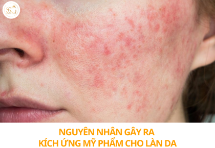 Kích ứng mỹ phẩm: Nguyên nhân, dấu hiệu và cách xử lý da bị kích ứng hiệu quả