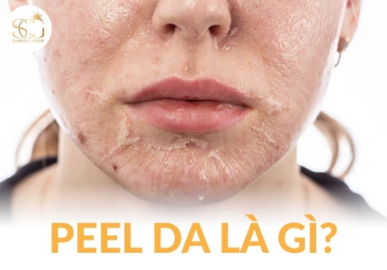 Peel da là gì? Công dụng, cách thực hiện và lưu ý an toàn khi peel da