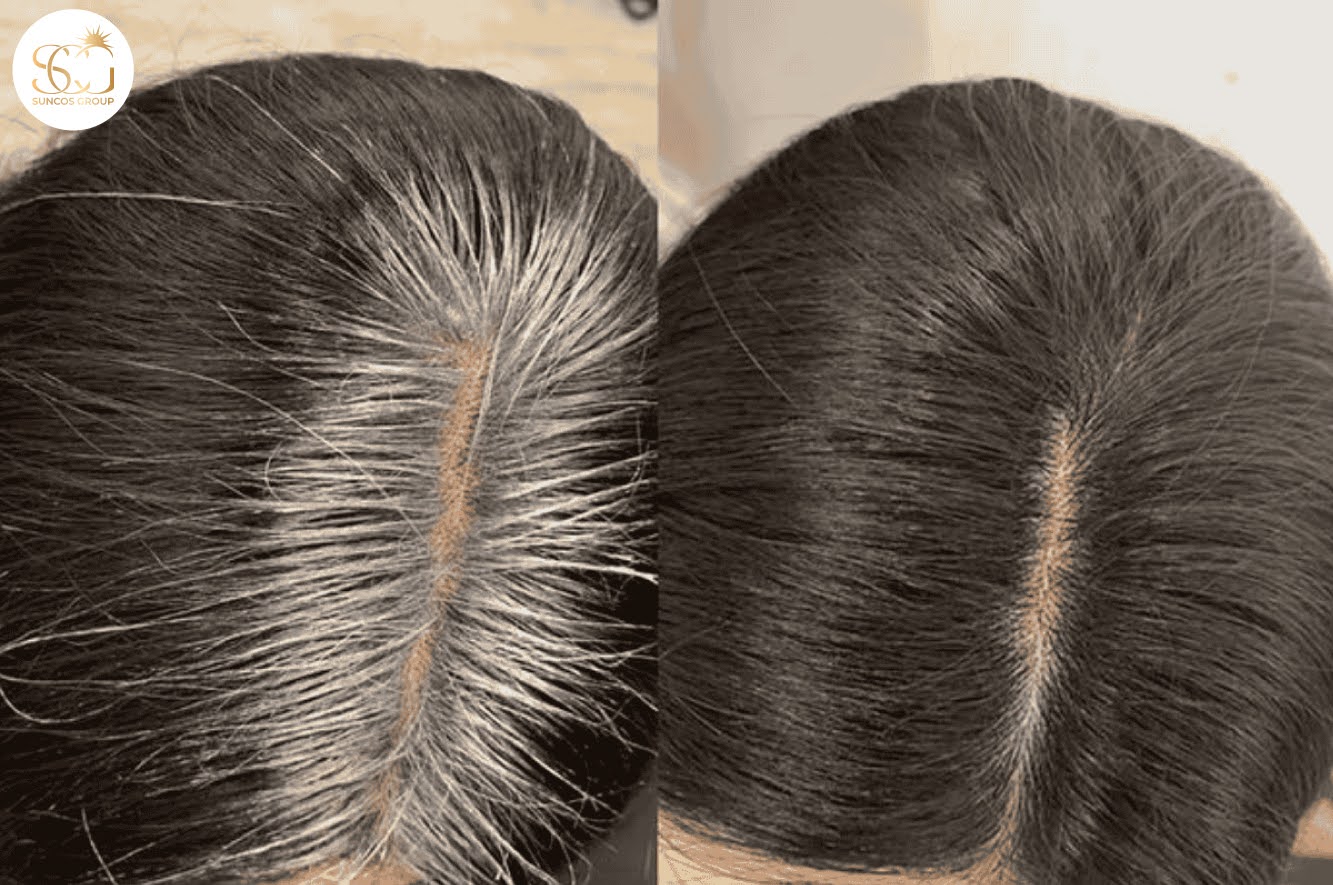 ưu điểm dầu gội phủ bạc