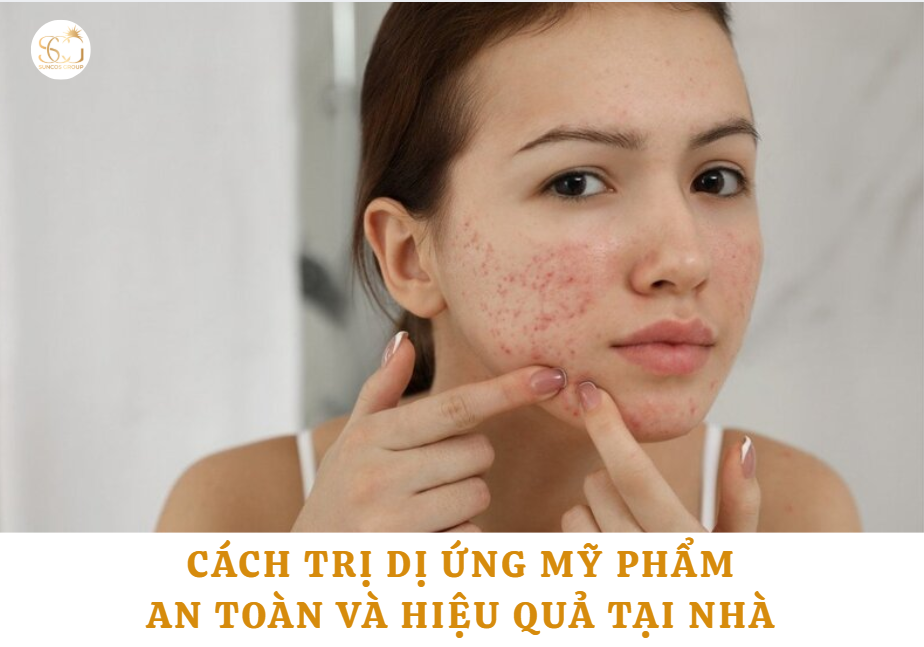 cách trị dị ứng mỹ phẩm
