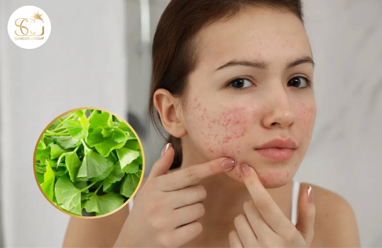 công dụng của rau má với da mặt